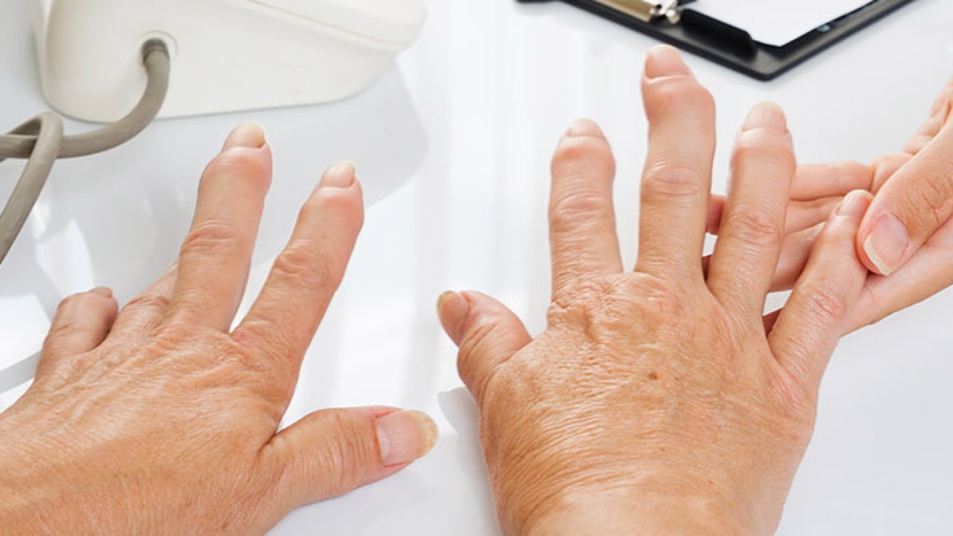 pdha-posts-arthritis